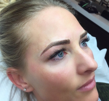 Brow transformation — Aesthetics by Erina